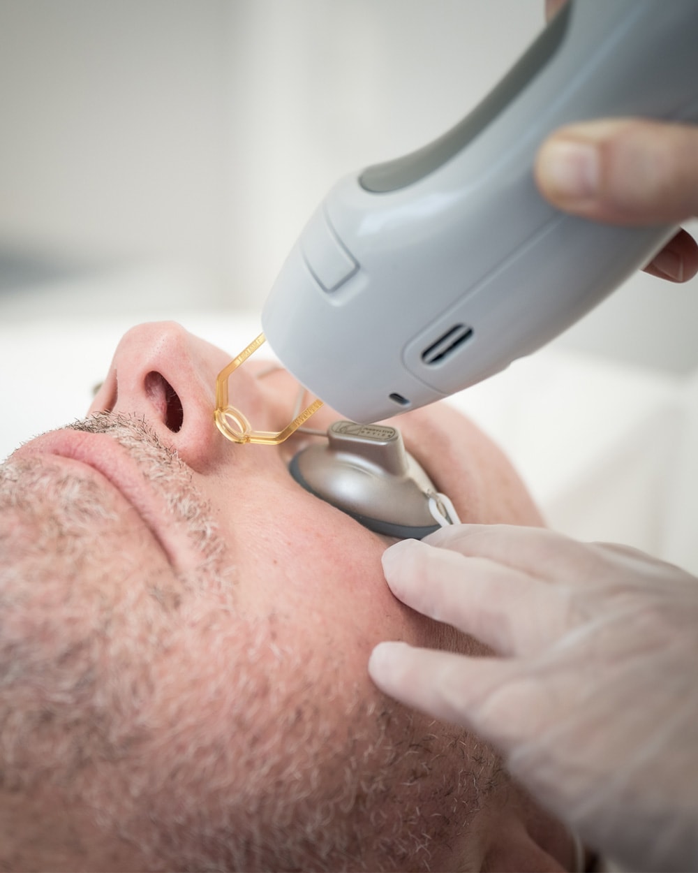 Séance de laser vasculaire par le médecin esthétique Dr Béatrice Goffre